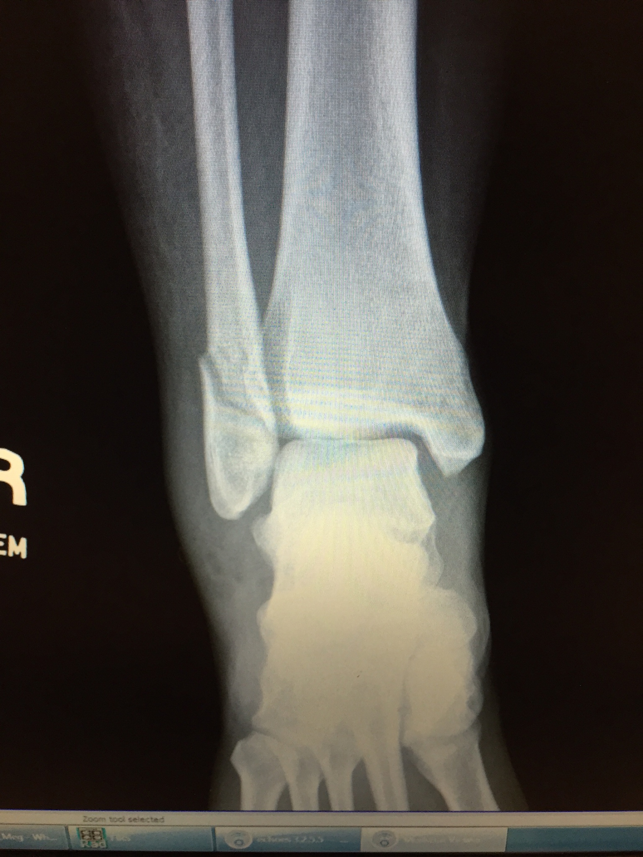 2015-08-10_0001.jpg 2015-08-10_0001.jpg